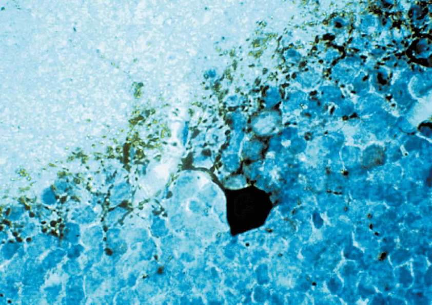 Cellules dopaminergiques de rétine